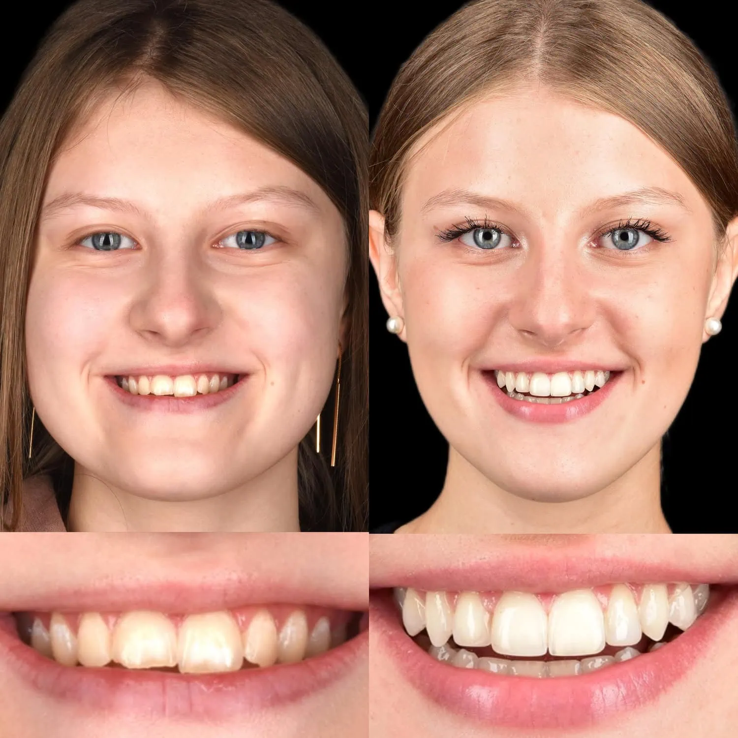 Unident-Union-photo-output 98 (1)