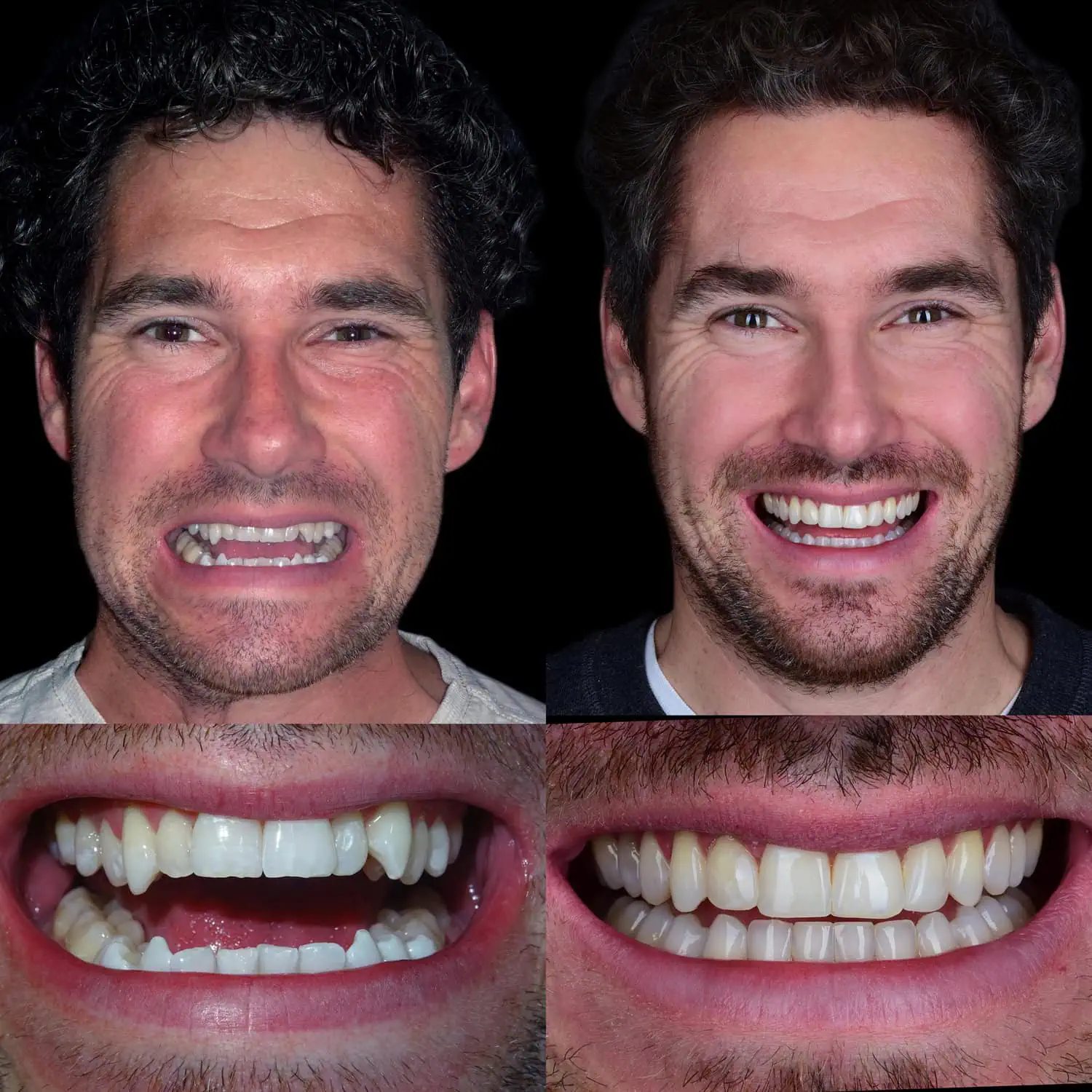 Unident-Union-photo-output 98 (2)