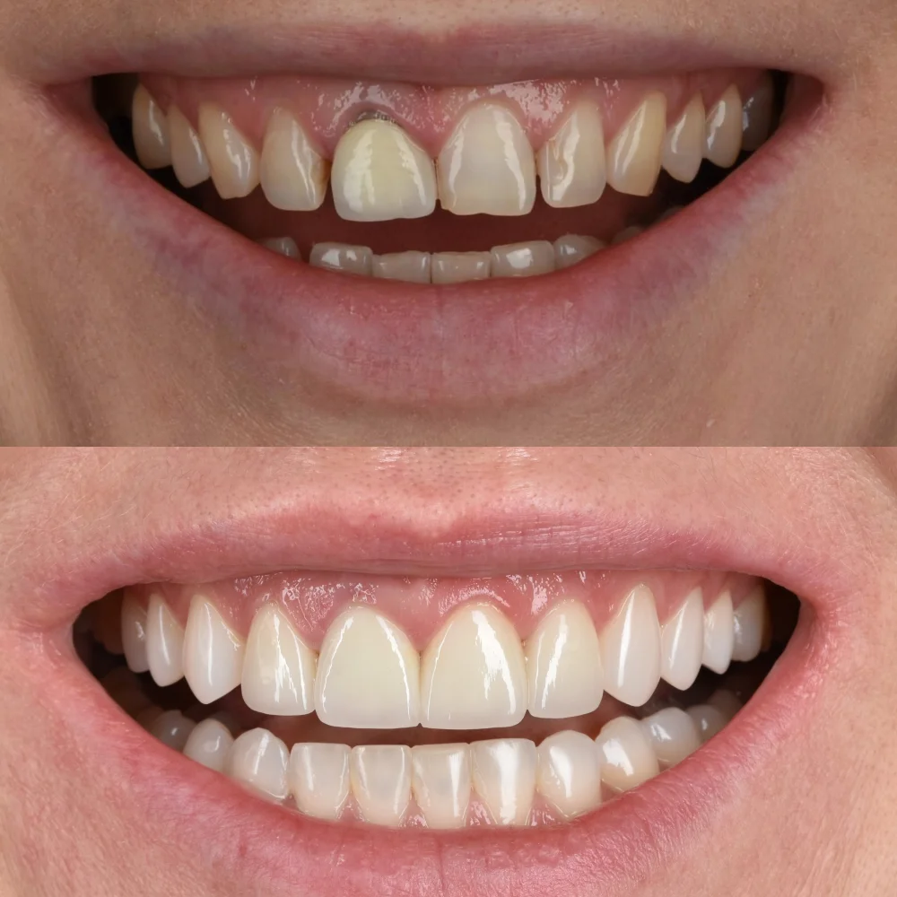 unident-union-endodoncja-1