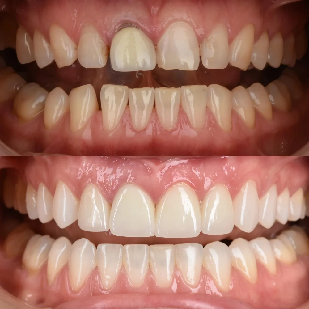 unident-union-endodoncja-2